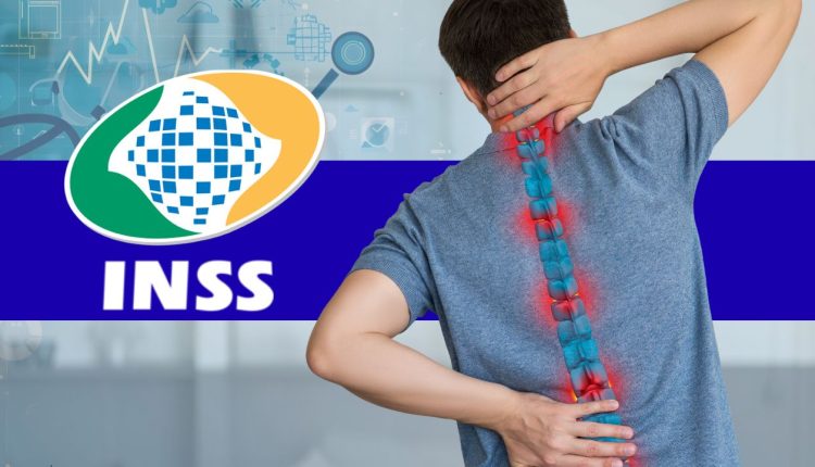 Aposentadoria Coluna